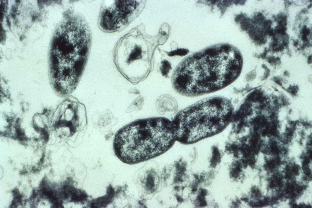 Legionella pneumophila bacteria